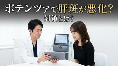 ポテンツァで肝斑が悪化？対策とは？
