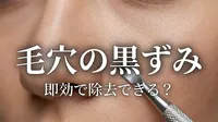 毛穴の黒ずみを除去するのは即効でできる？