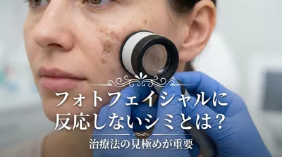 フォトフェイシャルに反応しないシミとは？