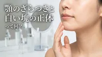 顎のざらつきと白い塊の正体って何？