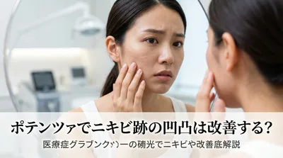 ポテンツァでニキビ跡の凹凸は改善する？