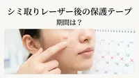 シミ取り レーザー 後の保護テープ 期間は？