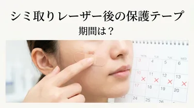 シミ取り レーザー 後の保護テープ 期間は？